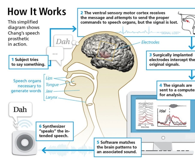 MindControl Translating Brain Signals to a Voice Synthesizer Emerj