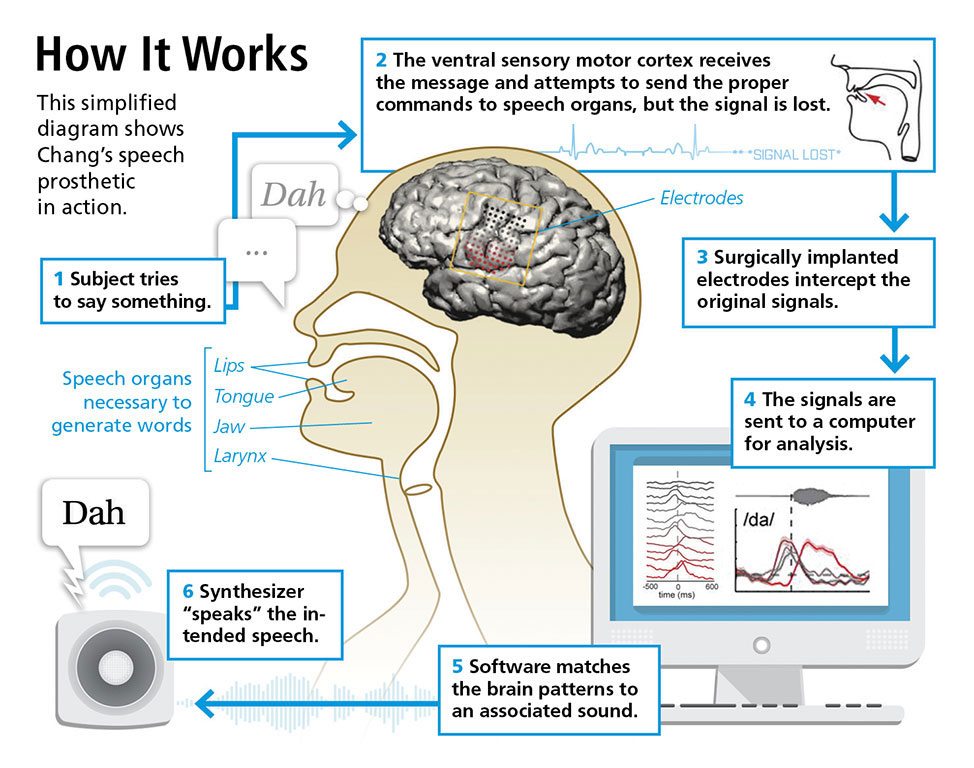 Speech brain. Компьютерный мозг. Мозг против компьютера. Сравнение компьютера и мозга. Сравнение мозга человека и компьютера.