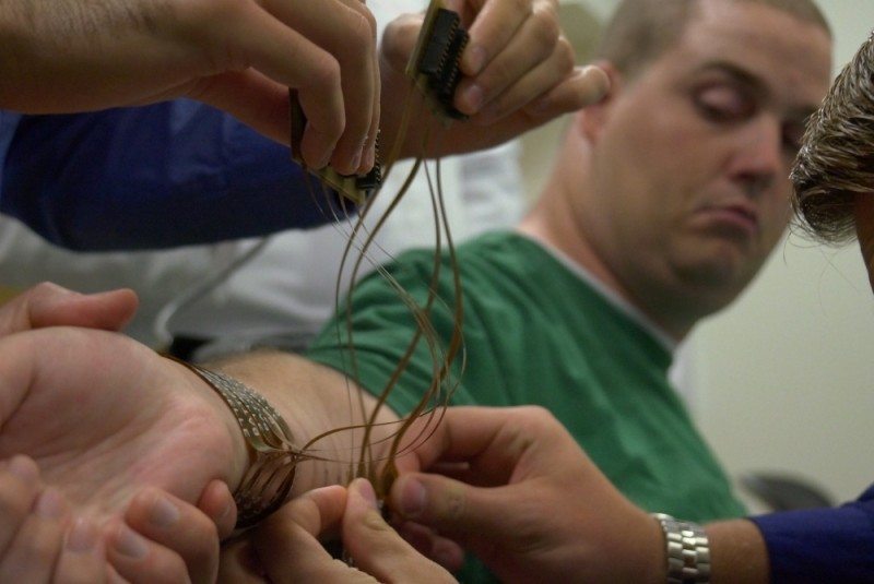 #MindControl: Brain Chip Moves a Paralyzed Man's Hand