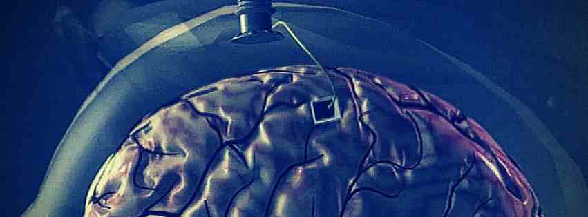 Wireless Brain Implants - The Implications of Neural Prosthetics