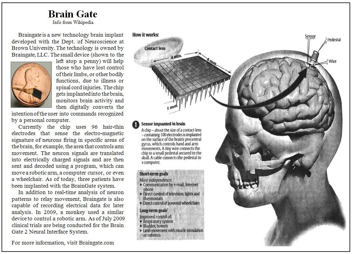 Brain-Machine Interface on the Cutting Edge – with BrainGate's Dr. Janos Perge