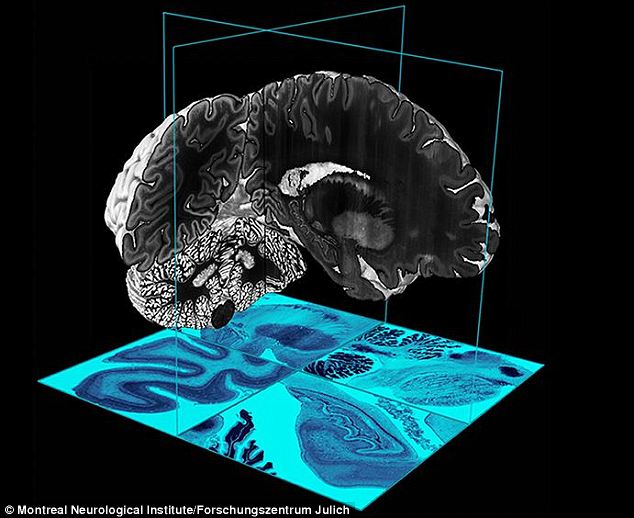 Episode #85 - What Would it Take to Model the Human Mind? - Computational Neuroanatomy with Dr. Gregory Hickok
