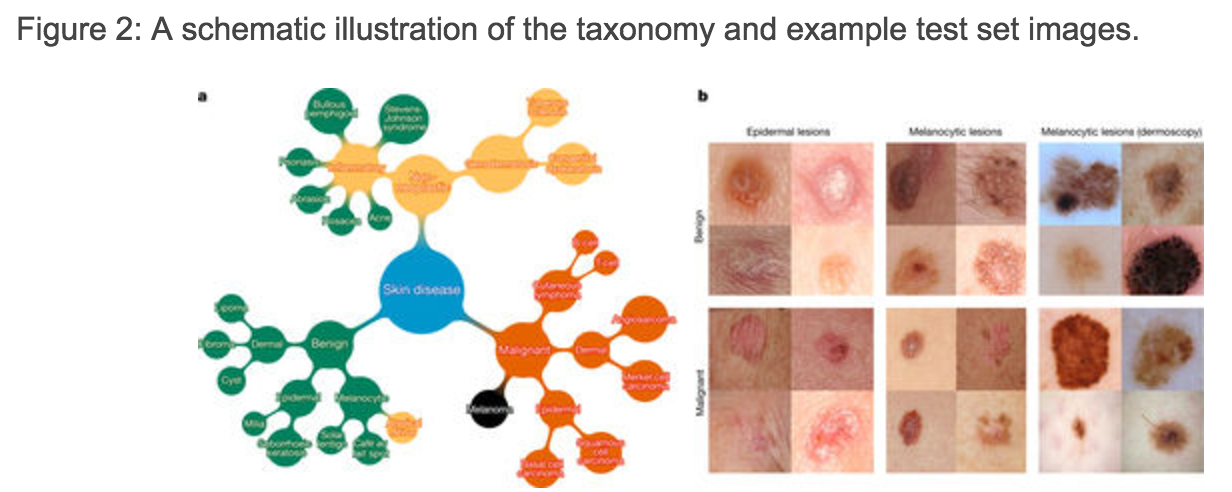 Skin Cancer Deep Learning